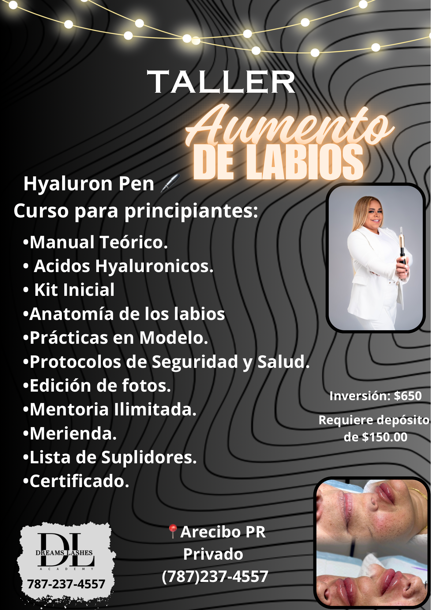Seminario Aumento de Labios